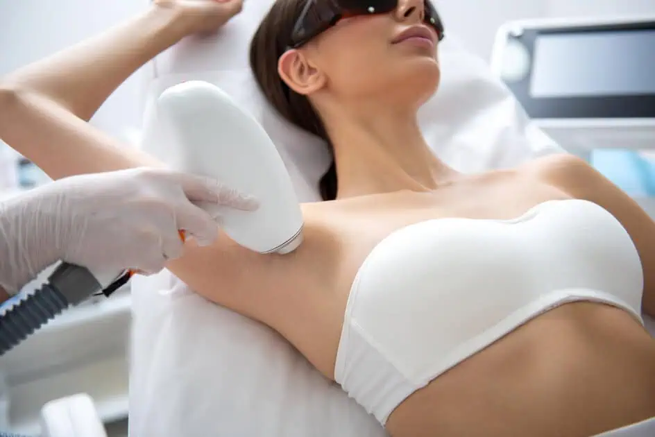 Laser Hair Removal